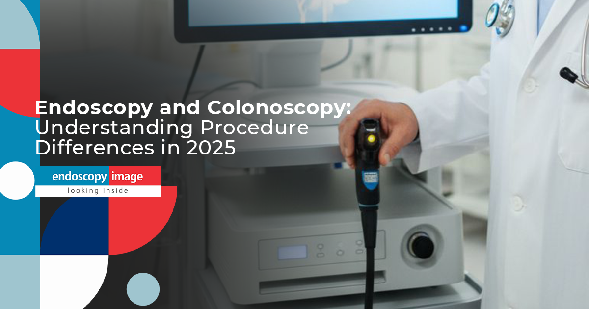 blog-endoscopy-and-colonoscopy-differences-endoscopy-image